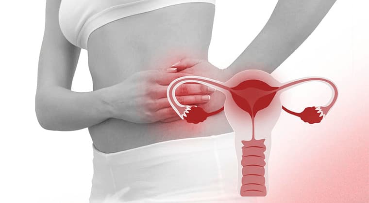 Enfermedad inflamatoria pelvica