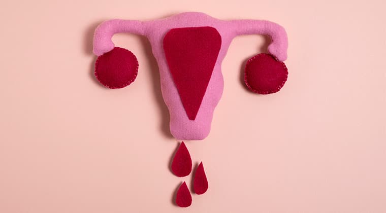 Flujo vaginal anormal